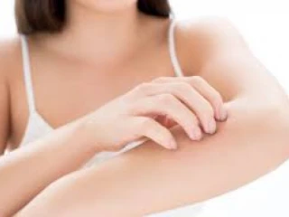 Pcd Pharma Franchise for Anti Scabies