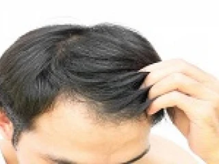 Pharma Franchise for Hair Treatment