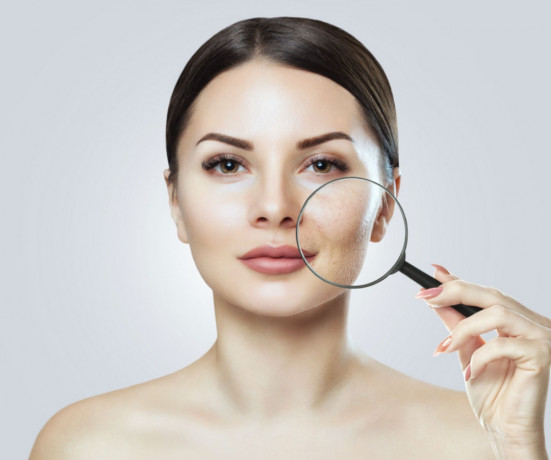Pharma PCD Franchise For Anti - Acne Medicine Range 1