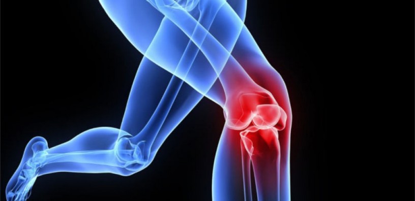 PCD Pharma Franchise for Orthopedic Range Products 1