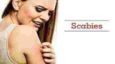 Anti Scabies Products