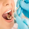 Dental Medicine PCD Companies
