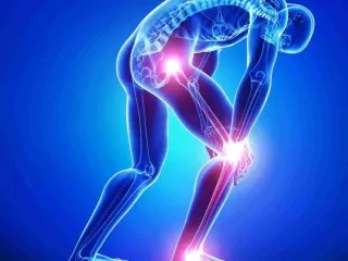 Orthopedics Range PCD Franchise Company