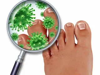 Pharma Franchise For Anti Fungal Range