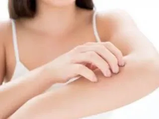 Pcd Pharma Franchise for Anti Scabies