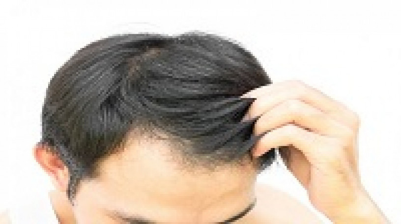 Pharma Franchise for Hair Treatment 1