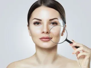 Pharma PCD Franchise For Anti - Acne Medicine Range