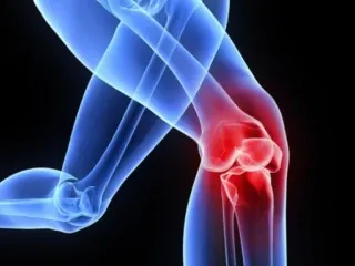 PCD Pharma Franchise for Orthopedic Range Products