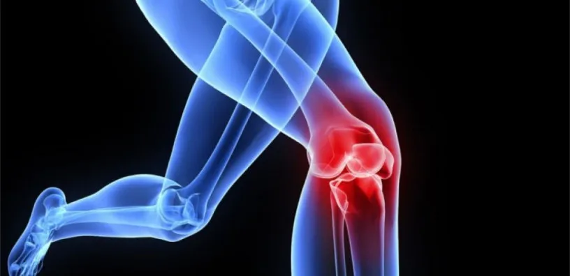 PCD Pharma Franchise for Orthopedic Range Products 1